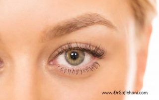 جراحی پلک