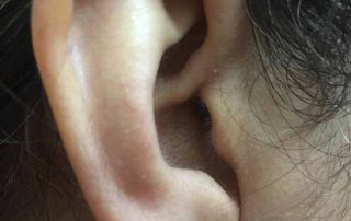 کاهش شنوایی