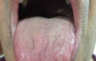 بوی بد دهان