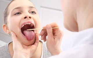 آبسه لوزه ها