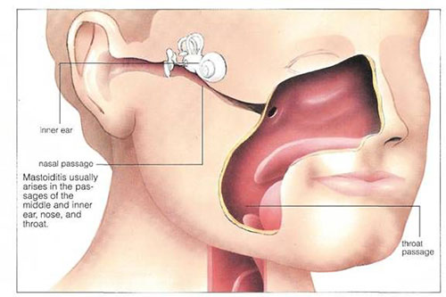 اختلال عملکرد شیپور استاش در گوش