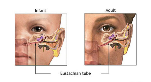 اختلال عملکرد شیپور استاش در گوش